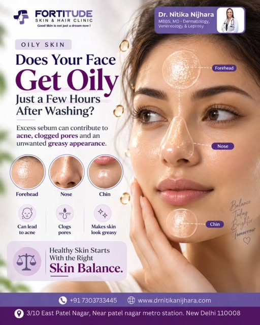 Struggling with oily skin just a few hours after washing your face? Excess sebum can contribute to a