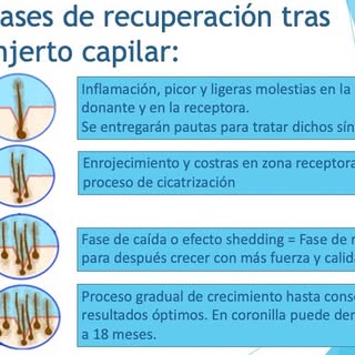 ✍️ Fases de recuperación después de un injerto capilar:

✅ 1-3 dias: podrá presentar inflamación en 