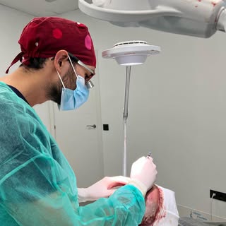 Fase de incisiones:

👉Previa a la implantación, el cirujano realizará unas incisiones transversales