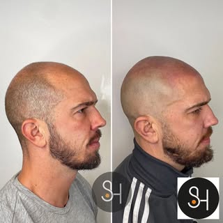 SMP is so much more than just pigment in the skin.

I’ve seen it time and time again. A client walks