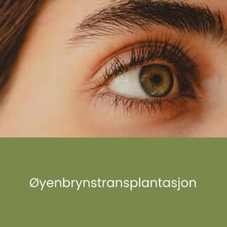 Øyenbrynstransplantasjon kan passe i de tilfeller der en person har generelt tynne øyenbryn, har ove