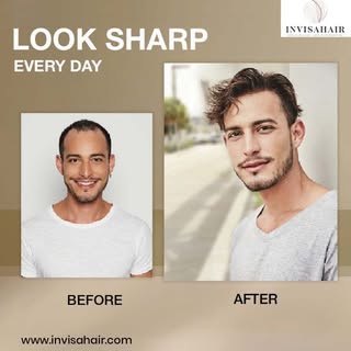 Modern men’s hair replacement focuses on confidence, realism, and everyday convenience. Invisahair i