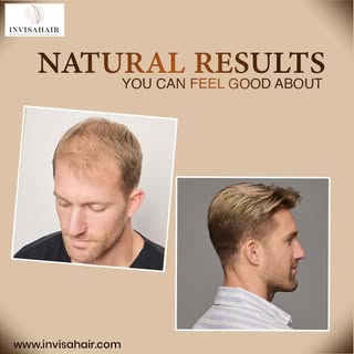 Hair loss doesn't have to define your confidence. Invisahair offers personalized hair restoration so