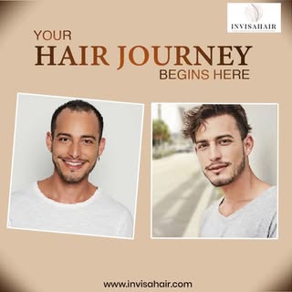 Choosing the right hair replacement solution starts with expert guidance. Invisahair provides free h