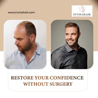 Regain confidence with non-surgical hair restoration solutions designed for a natural look and comfo