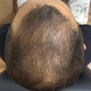 Clareoooou ☀️ 

Não é mágica, não é milagre.

Com o protocolo certo, o tratamento alinhado e discipl