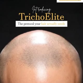 Your hair deserves more than just a "quick fix." ✨
Hair Loss ≠ One Cause. That's Why One Treatment I