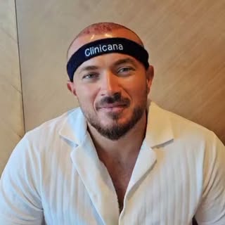 Am realizat cu succes procedura de implant de păr, cu un total de 4.000 de grefe implantate. 💇‍♂️
Î