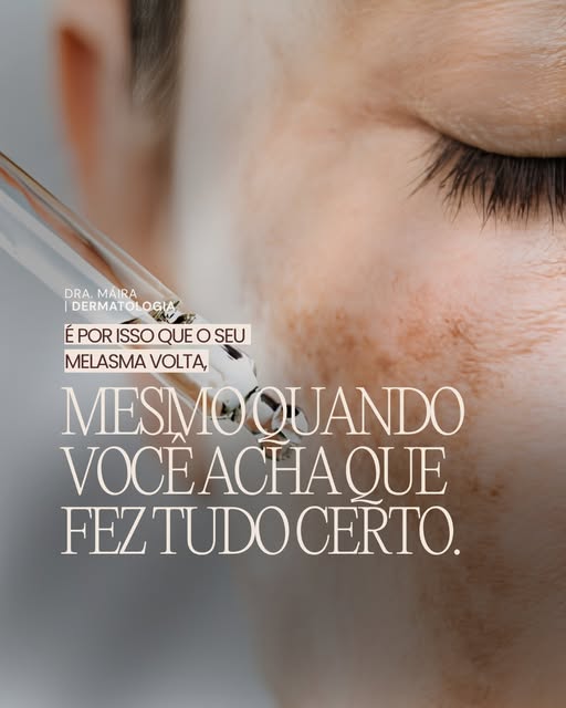 É por isso que o seu melasma volta, mesmo quando você acha que fez tudo certo.

Melasma não tem cura