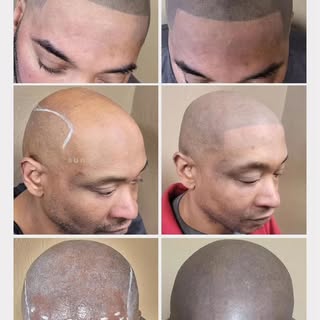 Scalp micro pigmentation specialist at 5151 Monroe St Suite 246 Toledo, Ohio 43623

 #CDEliteSMP
cde