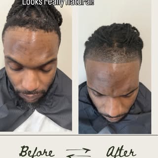 Scalp Micropigmentation isn’t just a cosmetic service, it’s a confidence reset.

If you’re dealing w