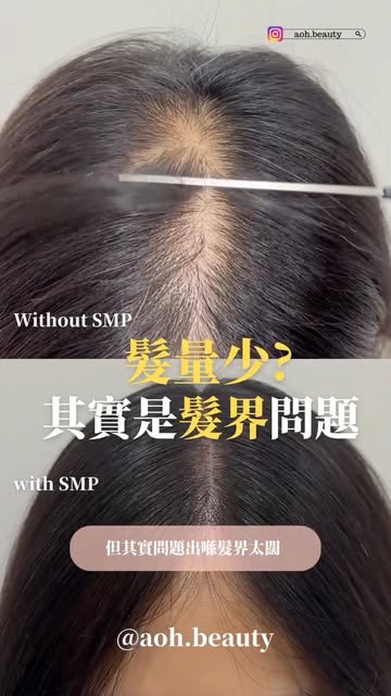 專注自然 安全至上

#成功個案超過3800
#過百好評不造假

本店配合AI 頭皮檢測儀 以大數據分析脫髮問題
🔸 透明收費，無隱藏費用
🔸 終身會員制，提供永久補色服務，單次收貴，價錢更實惠
