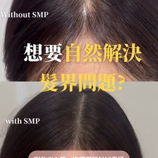 三次有效改善外觀問題🩵

#成功個案超過3800
#過百好評不造假

本店配合AI 頭皮檢測儀 以大數據分析脫髮問題
🔸 透明收費，無隱藏費用
🔸 終身會員制，提供永久補色服務，單次收貴，價錢更
