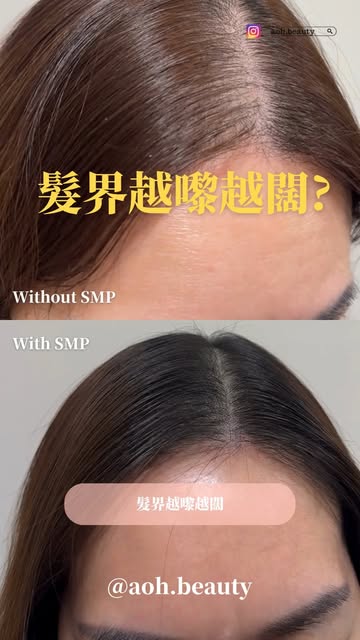 專注自然 安全至上

#成功個案超過3800
#過百好評不造假

本店配合AI 頭皮檢測儀 以大數據分析脫髮問題
🔸 透明收費，無隱藏費用
🔸 終身會員制，提供永久補色服務，單次收貴，價錢更實惠

