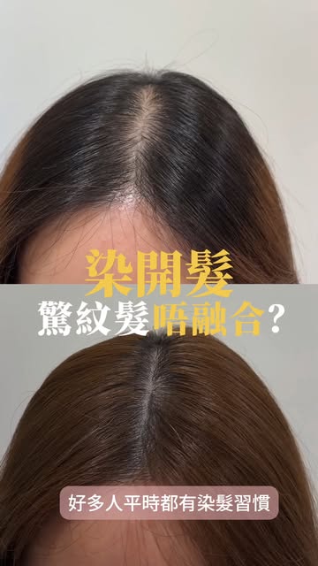啡色頭髮，都可以做紋髮嗎？🤎

答案係可以㗎！

呢位客人完成第 3 次 SMP 後，原本較寬、明顯嘅髮縫，視覺上變得細緻飽滿，髮量感亦自然提升。

紋髮並唔係一味用黑色填滿頭皮，而係會因應客人嘅髮