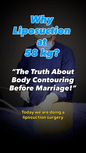 Not everyone who chooses liposuction is overweight.

Today, we performed liposuction for a 23-year-o