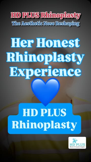✨ “I finally love my nose!” ✨

Nothing is more rewarding than seeing a confident smile after Rhinopl