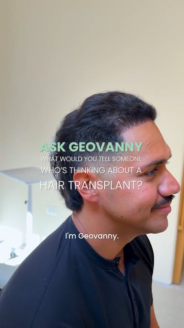 The only thing Geovanny regrets about his FUE hair transplant? Not doing it sooner 👀

After years o