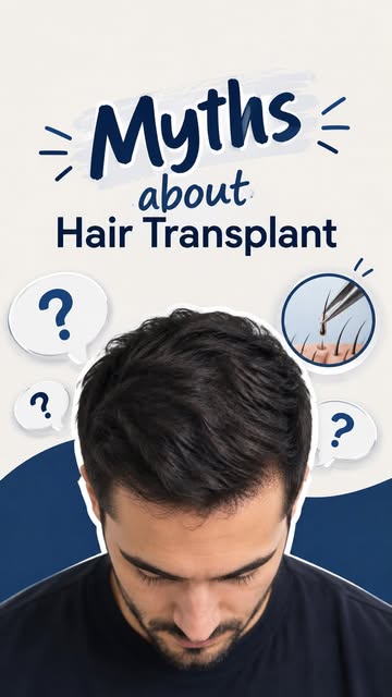 Hair Transplant Myths 👀
TRUE or FALSE? 🧠

Let’s bust the myths and get the facts straight.
How man