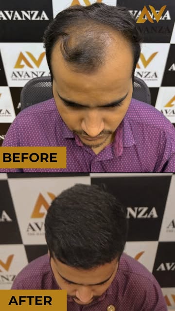 Every hair transformation has a story, and this is one of them. ❤️

From the before to the after, wi