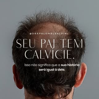 Seu pai ter calvície não significa que a sua história será exatamente igual à dele.

A genética pode
