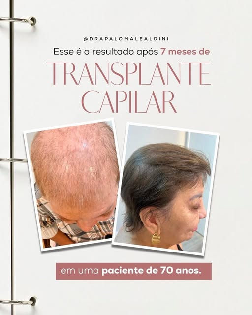 Tem histórias que emocionam justamente porque não falam sobre mudar quem a gente é.

Aos 70 anos, el
