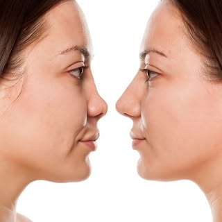 Aesthetic change is wonderful if the results look natural and are in balance with the other features