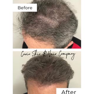 Big difference! Using only the best for our clients ⭐️
 Organic Grade A Pigmentation = Amazing resul