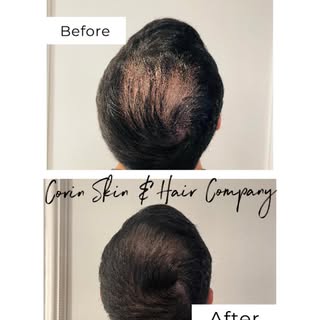 Join the countless clients who’ve reclaimed their look with us. Ready for your transformation? 💫. 
