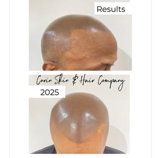 ✨Results ✨