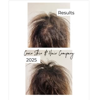 ✨ For my ladies , Results ✨