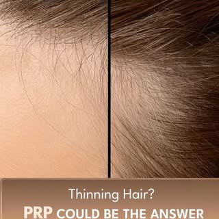 If you’ve been noticing more hair fall, reduced volume or a widening parting, it’s time to understan
