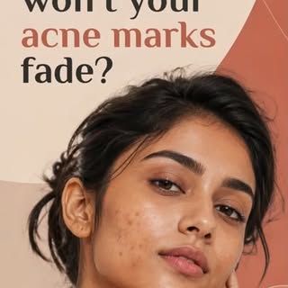 Acne may heal, but the marks it leaves behind often need targeted treatment. A dermatologist can ide