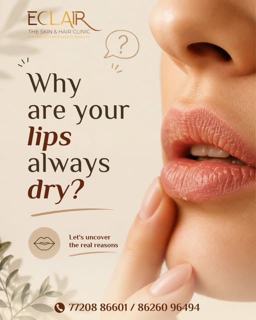 If your lips stay dry or cracked despite using lip balm, it may be time for a professional evaluatio