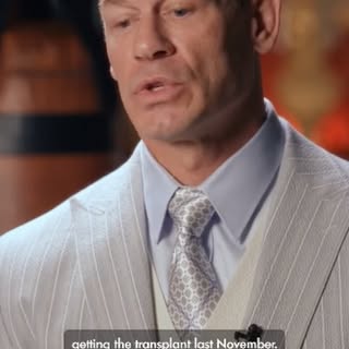 Even John Cena has realized it — the ultimate solution for hair loss is a Hair Transplant! 🧑‍🦲➡️🧑