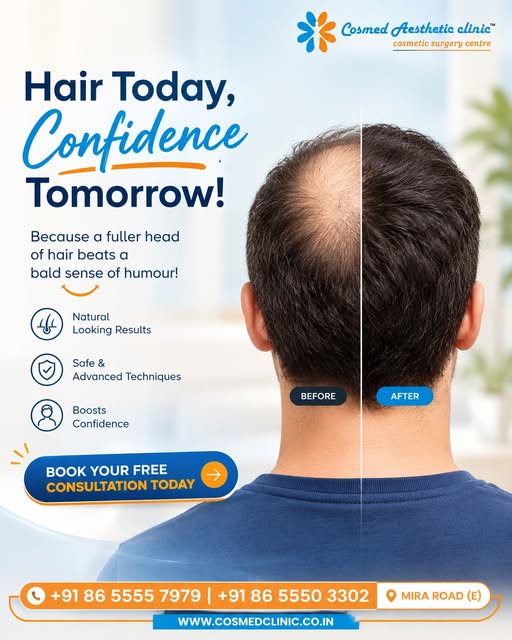 ✨ Hair Today, Confidence Tomorrow! ✨

Hair loss doesn't have to define your confidence. Whether you'