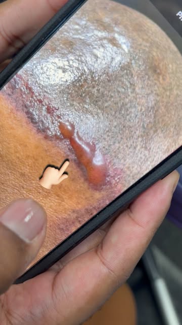 Another One that needed laser removal 😞..SMP is a ART..When my clients leave they represent me in t