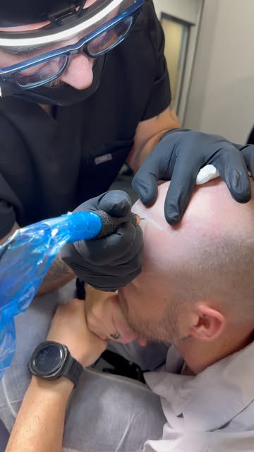 Who needs #ai when you got #gerow 😎✅ First session \Natural hairline #scalpmicropigmentationtrainin