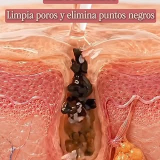 ✨ ¿𝐒𝐚𝐛𝐞𝐬 𝐪𝐮é 𝐧𝐞𝐜𝐞𝐬𝐢𝐭𝐚 𝐫𝐞𝐚𝐥𝐦𝐞𝐧𝐭𝐞 𝐭𝐮 𝐩𝐢𝐞𝐥?

🧼 𝐀́𝐜𝐢𝐝𝐨 𝐬𝐚𝐥𝐢𝐜í𝐥