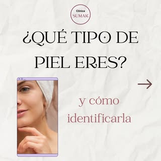 ✨ ¿𝐐𝐔É 𝐓𝐈𝐏𝐎 𝐃𝐄 𝐏𝐈𝐄𝐋 𝐓𝐈𝐄𝐍𝐄𝐒? 👀

¿𝐍𝐨𝐫𝐦𝐚𝐥, 𝐦𝐢𝐱𝐭𝐚, 𝐠𝐫𝐚𝐬𝐚, 𝐬𝐞𝐜𝐚 𝐨