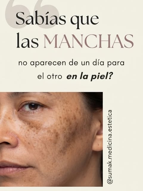 ¿Te has mirado al espejo después del verano y has notado nuevas manchitas en tu piel? ☀️🍂
Es totalm