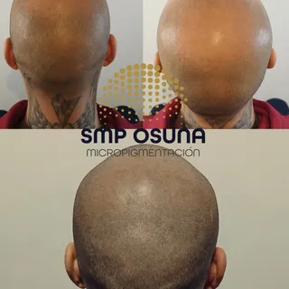 •Efecto rapado🔝 Coronilla totalmente camuflada
🔥Cambio brutal🔥
Buscas un cambio como este?
Nuestr