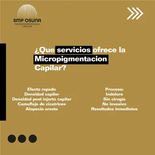 Nuestros servicios ✨
#micropigmentation 
#micro 
#microcapilar 
#microscalp