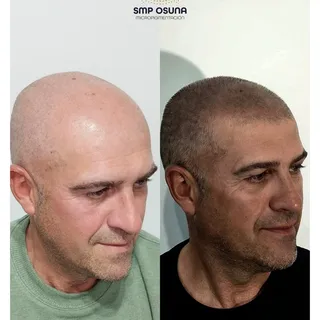 Micropigmentacion Capilar ✨ efecto rapado pelo corto👌😎 Cambio 🔝 
Buscas quitarte unos años  y luc