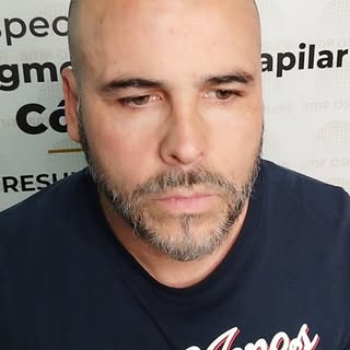 Efecto rapado✨🥇
La  Micropigmentacion Capilar una vez más demuestra cómo cambia la vida de las pers