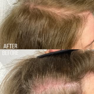 Noticing thinning? You’re not alone.

Dr. Kumar at HRC focuses on personalized treatments that suppo