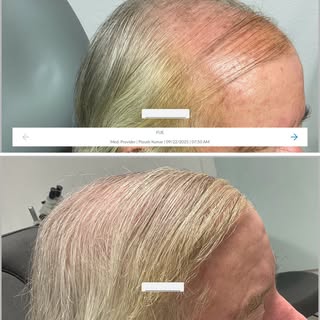 Real results start with the right hair restoration plan ✨

FUE and hair restoration treatments at HR