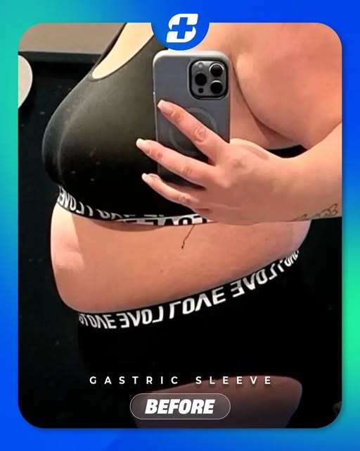 Every journey is personal, and every result can look different. ⭐

Swipe through to see this patient