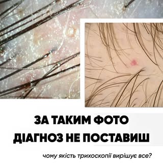 “Проведіть, будь ласка, онлайн-консультацію. Я маю трихоскопію. Мені потрібно поставити точний діагн