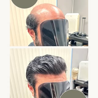 🔥 Say hello to the SU-BH-14, our thinnest stock hair system yet! 🔥

With a 0.03mm micro-thin skin 